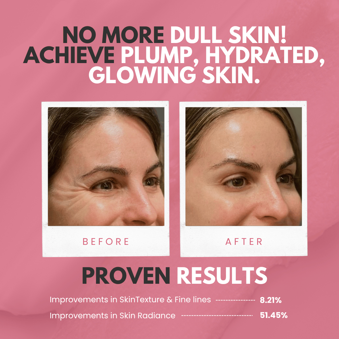 Veglow™ Salmon PDRN Collagen Mask