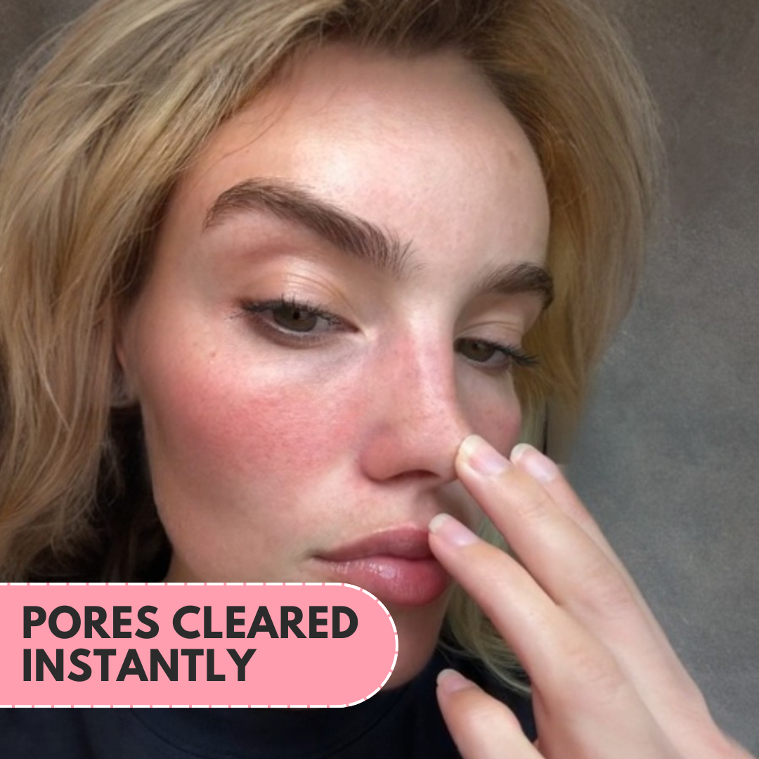 Veglow™ Nose Patches