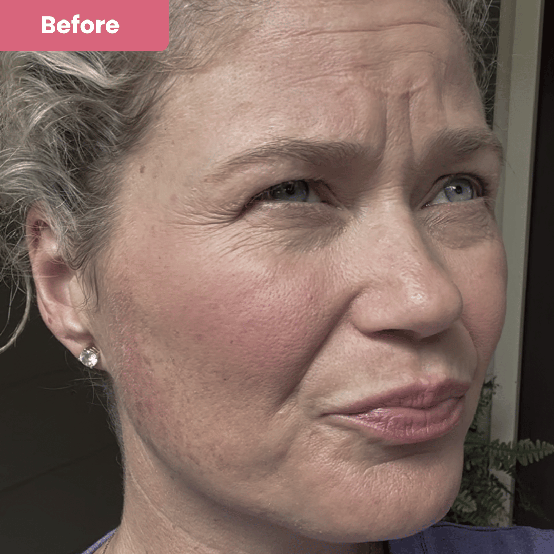 Veglow™ Salmon PDRN Collagen Mask