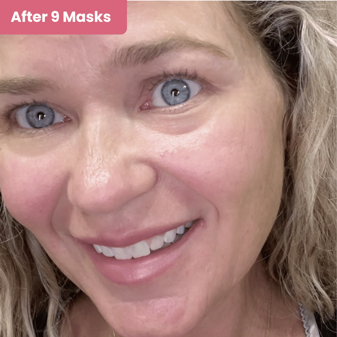 Veglow™ Salmon PDRN Collagen Mask