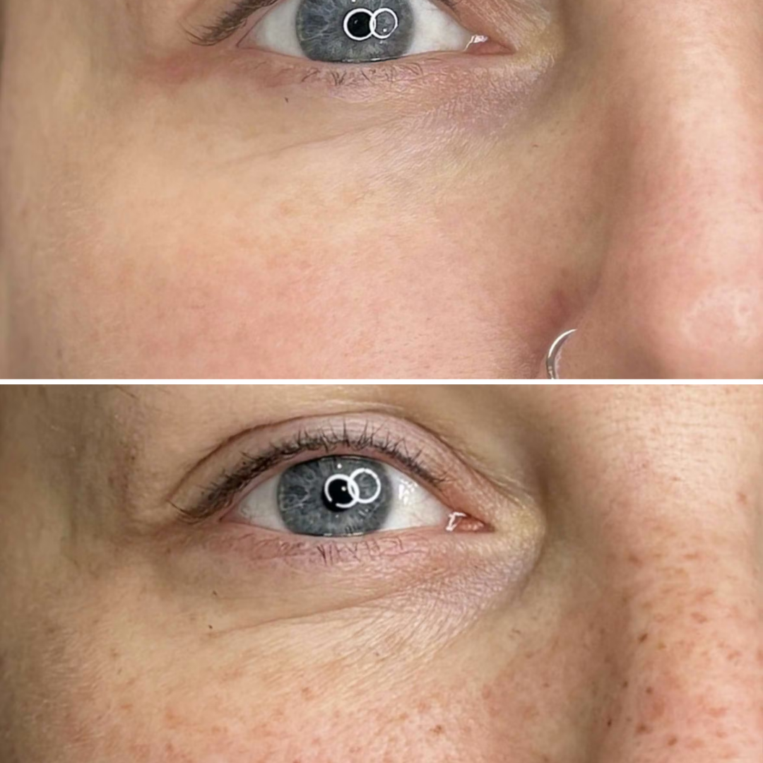 VeGlow Deep Collagen Serum