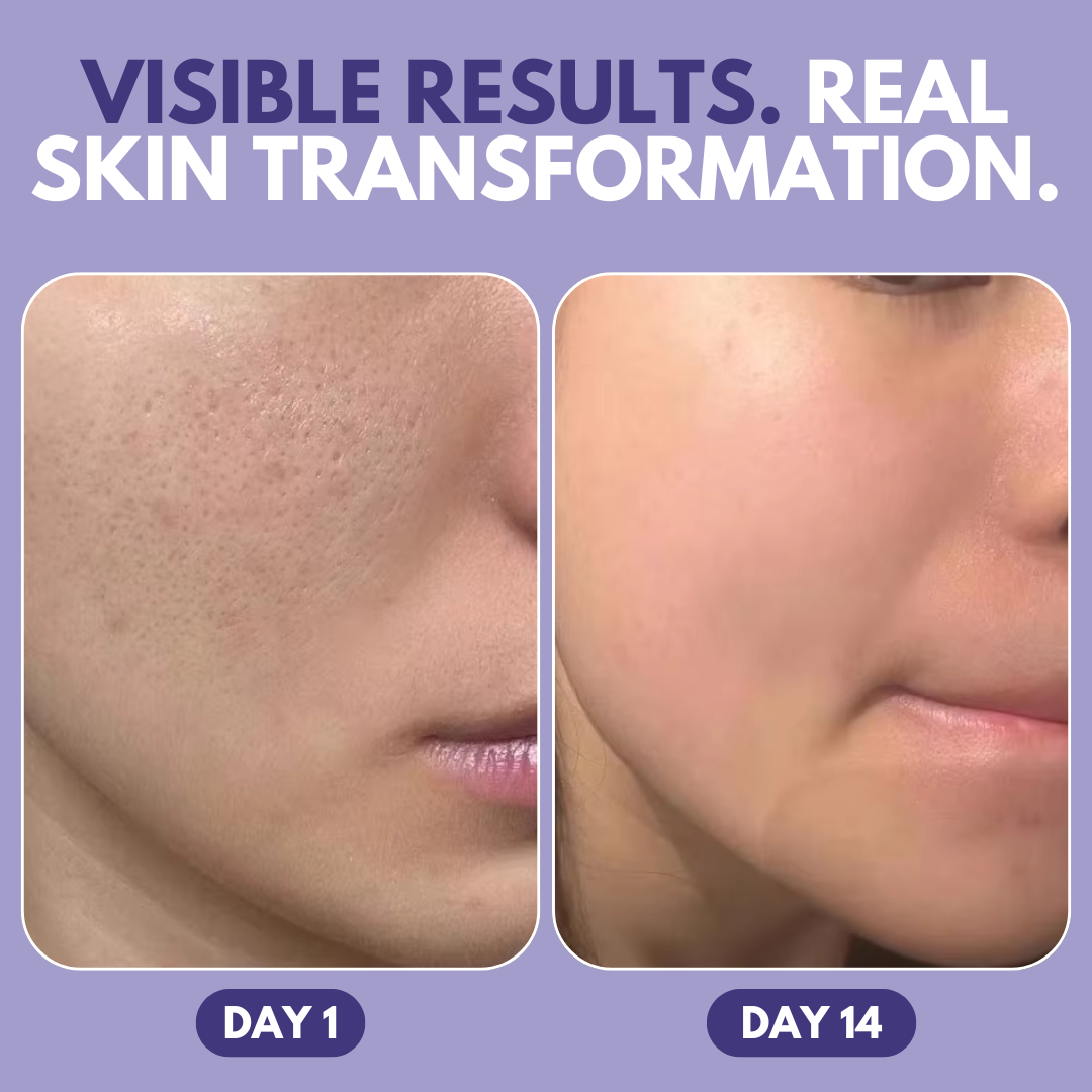 Veglow™ 3% Ultra Hydrating Hyaluronic Acid