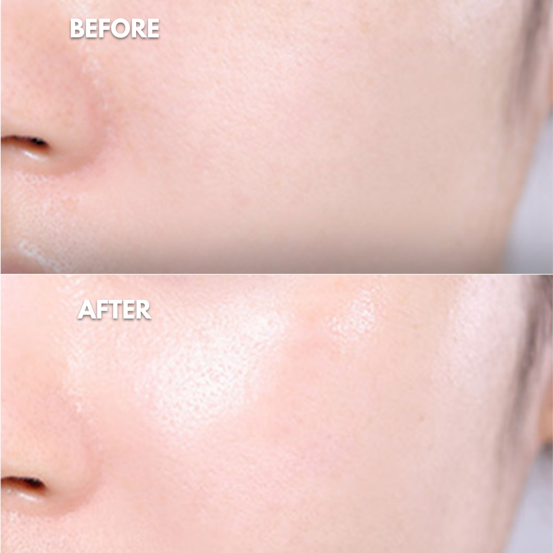 Veglow™ Toner Pads