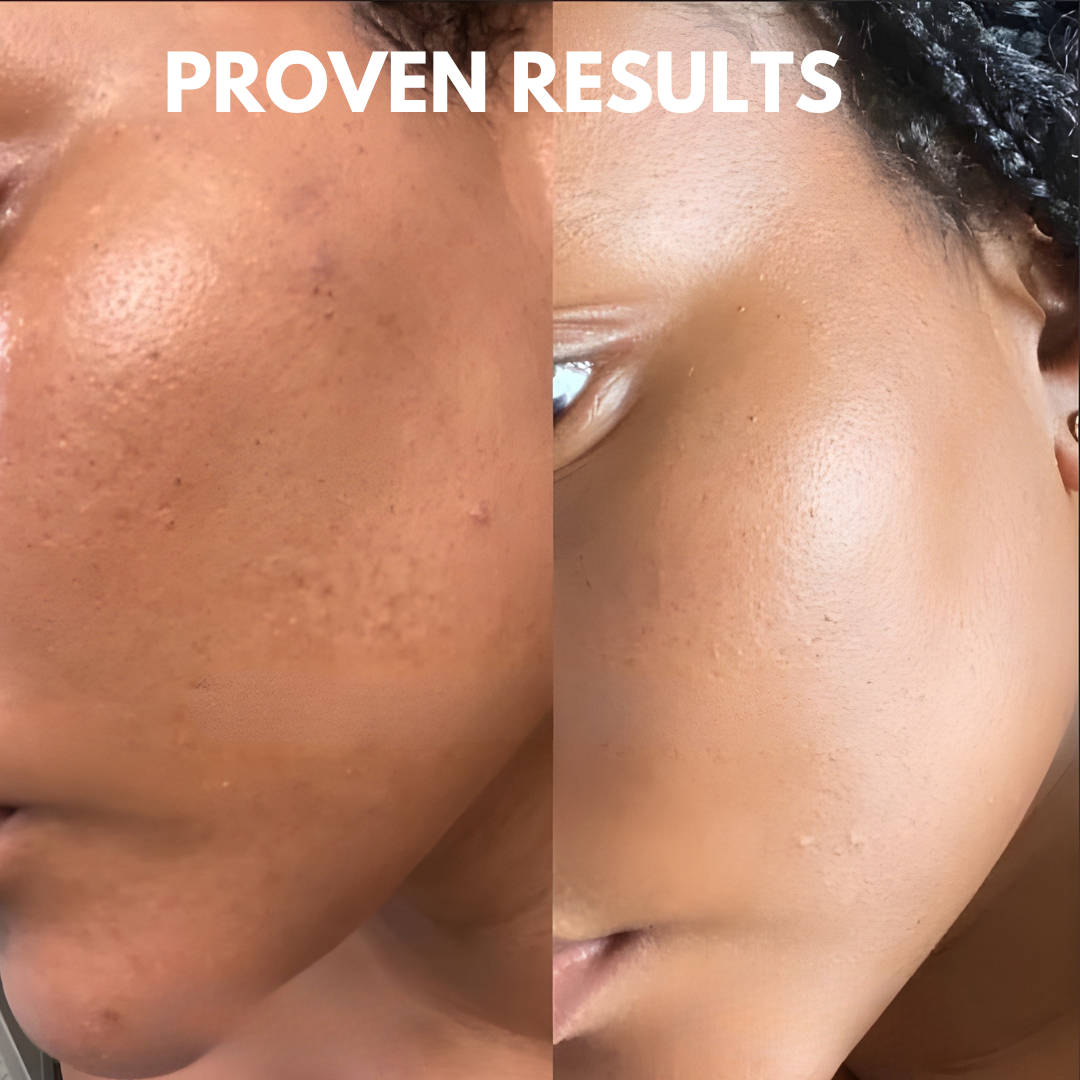 Veglow™ PDRN Pink Peptide Serum