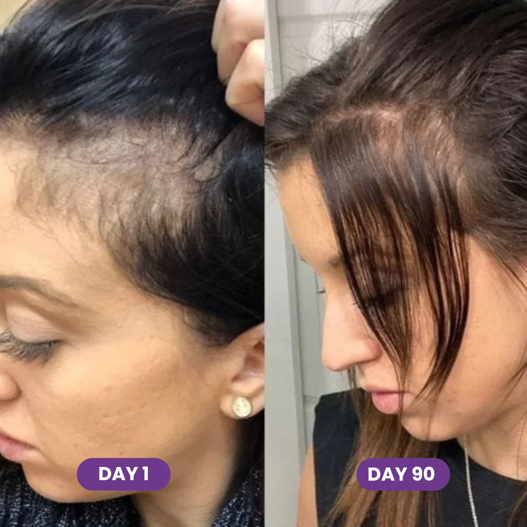 Hair Growth Accelerator Gummies